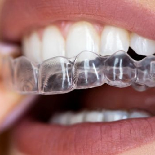 Aligner  İçin Yuvarlak Sert  Plak 1.0  mm. Kod:122   (25 Adetlik Paket)